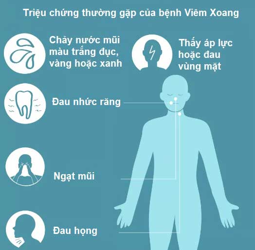 triệu chứng nhận biết bệnh xoang mũi triệu chứng nhận biết bệnh xoang mũi