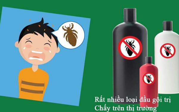 Các loại dầu gội trị Chấy