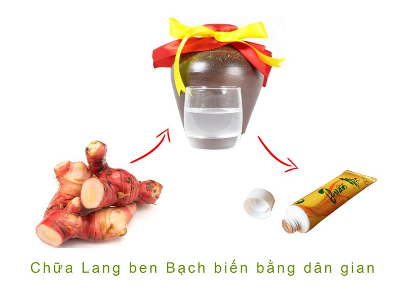 chữa lang ben bạch biến bằng thuần mộic