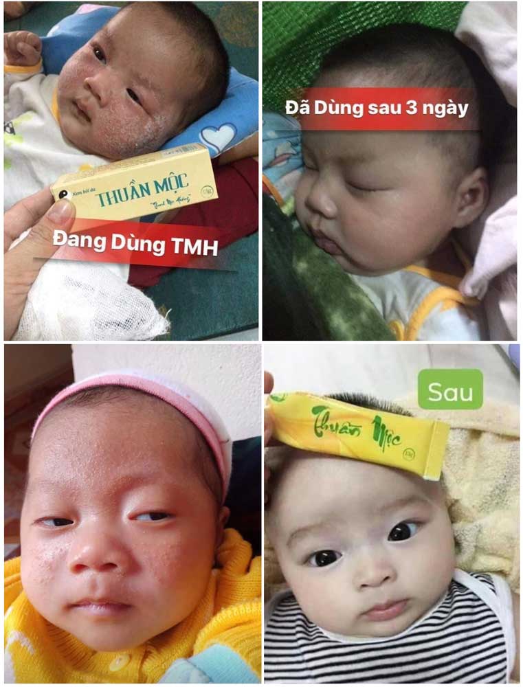 kem thuần mộc dùng cho trẻ sơ sinh