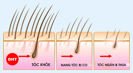 dht tác động lên chân tóc